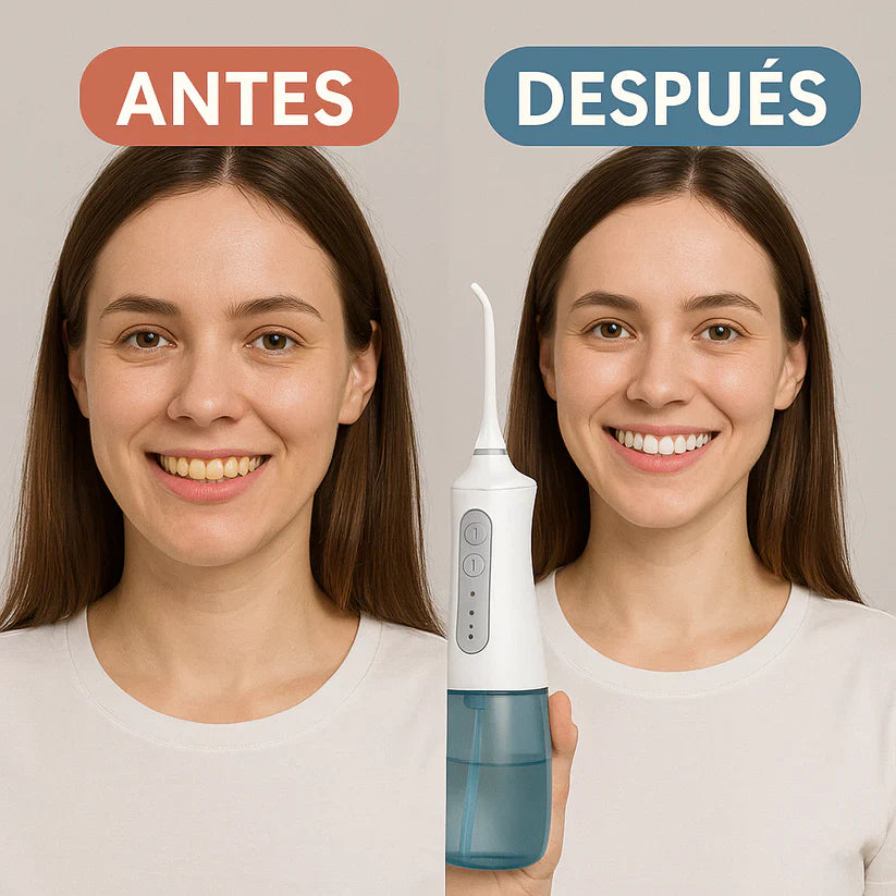 ¡Dientes Más Limpios en Segundos! Irrigador Oral Recargable con Entrega Gratis y Pago Contraentrega